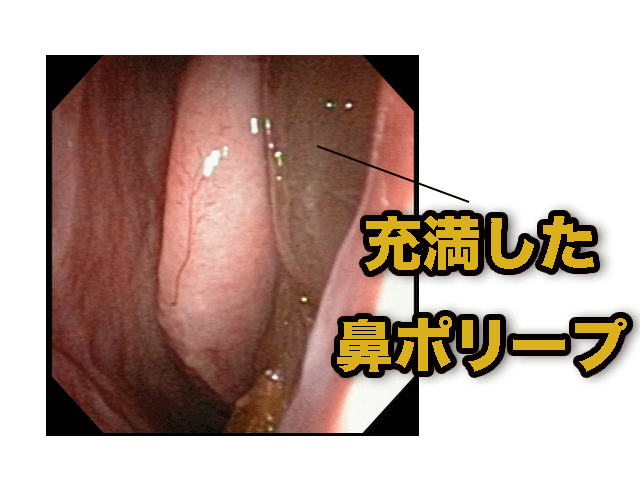 手順は何ですか?